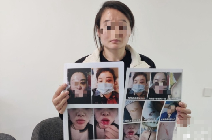 鄭州一女子稱被企業(yè)家丈夫長期家暴，起訴離婚要撫養(yǎng)權(quán)